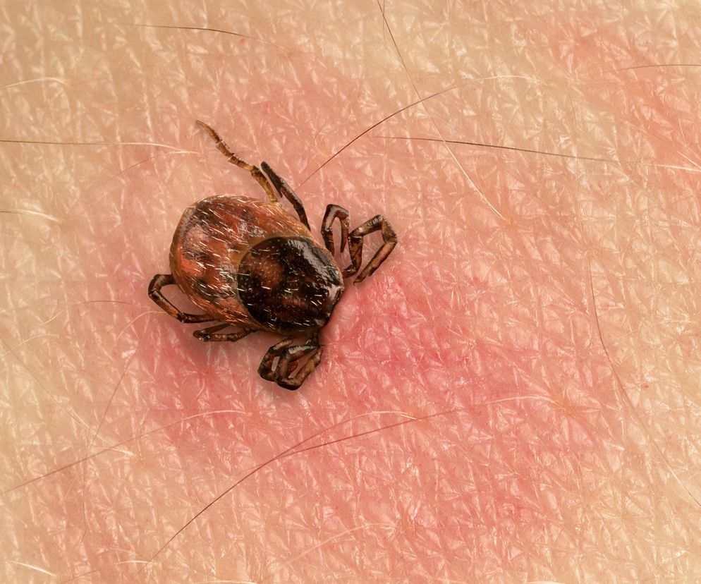 Odkryto nowy sposób na kleszcze. Jest naturalny i super skuteczny