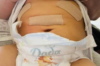 15-miesięczna Anastazja z Torunia potrzebuje pomocy