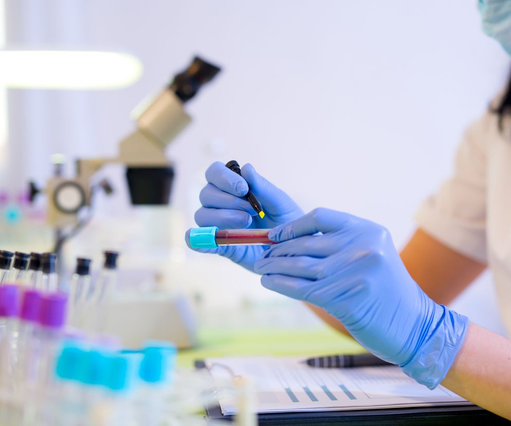 Kobieta pracującą w laboratorium oznacza próbkę krwi do badania. 