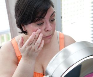 Skąd się bierze obrzęk twarzy o poranku? To może być sygnał tych schorzeń