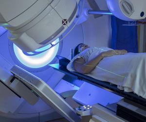 Radioterapia: jak działa? Skutki uboczne radioterapii