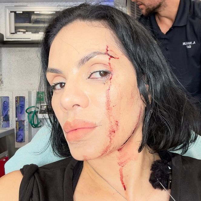 Influencerka kręciła film na Instagrama. Nagle uderzyło w nią auto!