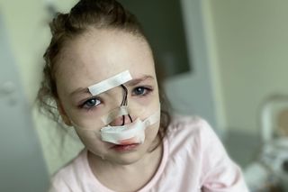 Podziękuję za opieszałość i zaproszę na pogrzeb.  Chorzy z rzadkimi mutacjami skazani na śmierć