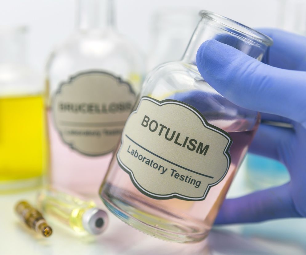 Botulizm: zatrucie jadem kiełbasianym