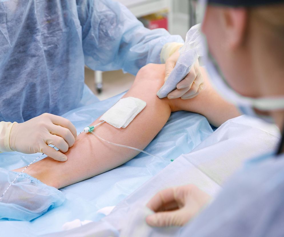 Porada chirurga naczyniowego