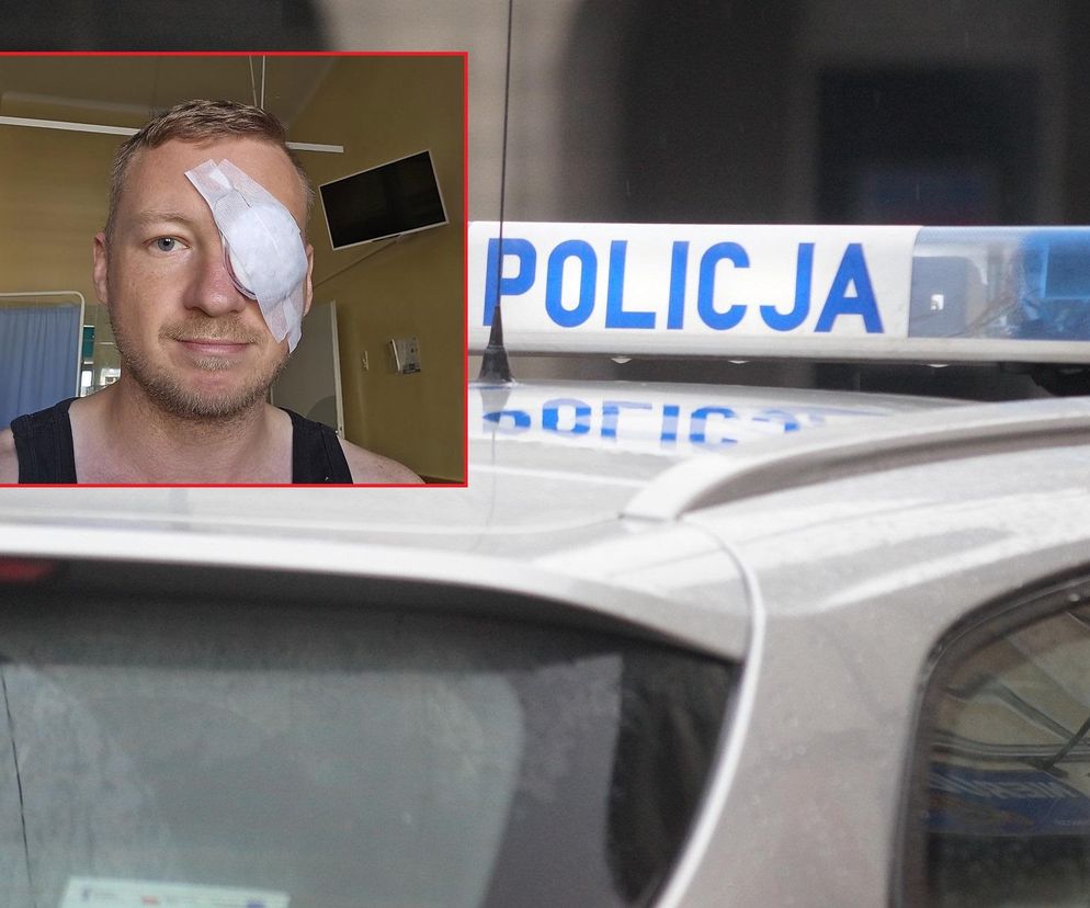 Ktoś strzela do ludzi w Toruniu! Znany dziennikarz poważnie ucierpiał. Wszystko opisał