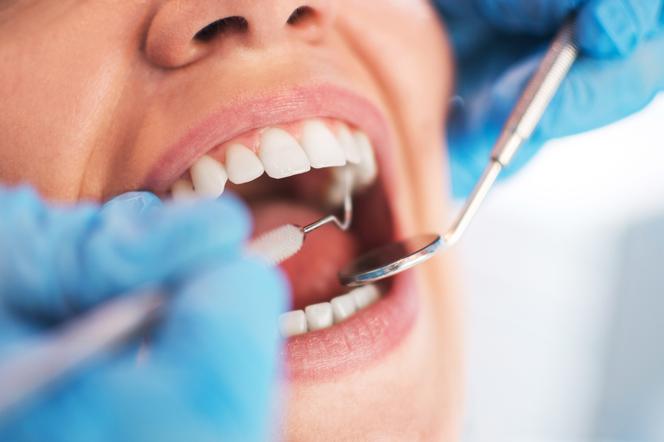 Przegląd stomatologiczny niezbędny dla zdrowia jamy ustnej i zębów. 