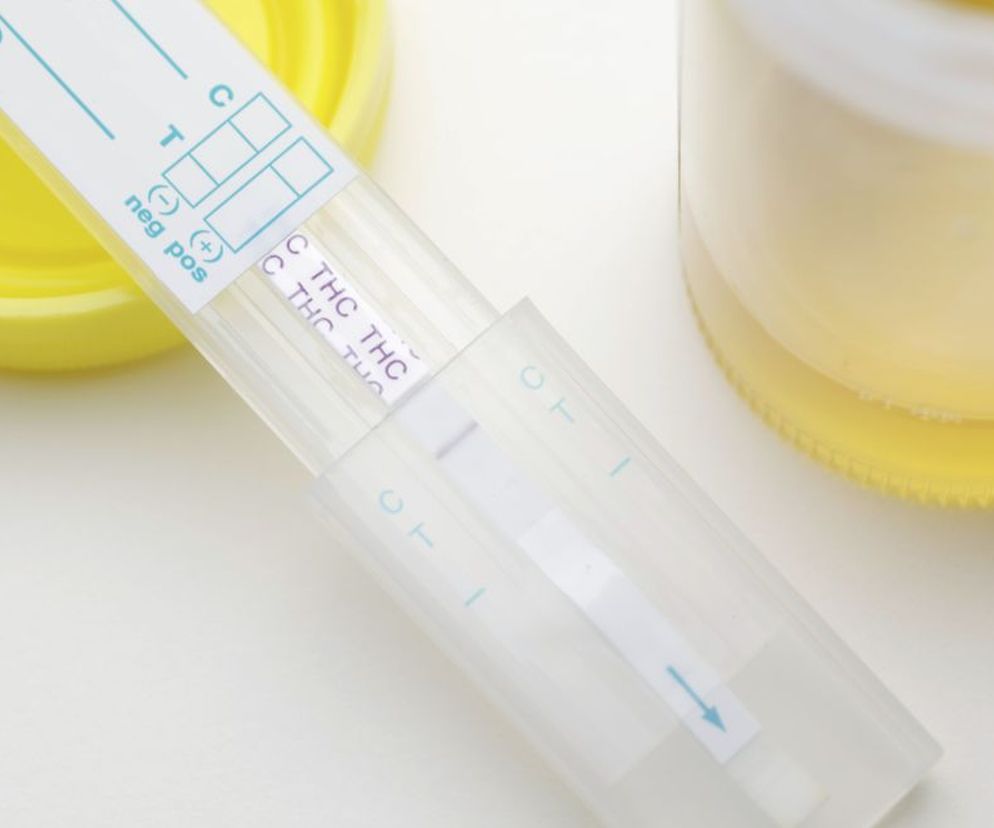 Testy na obecność THC (tetrahydrokannabinolu) badają mocz lub przedmioty użytku osobistego