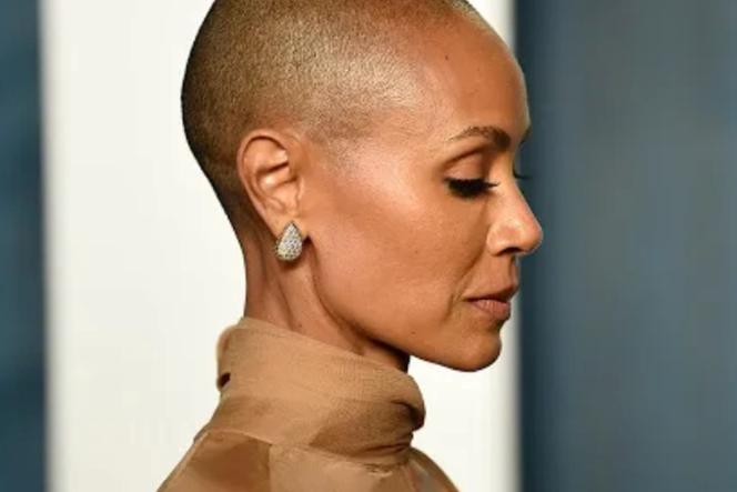 Nie tylko Jada Pinkett Smith, na alopecję chorują tysiące. Pomoże im lek na zapalenie stawów?