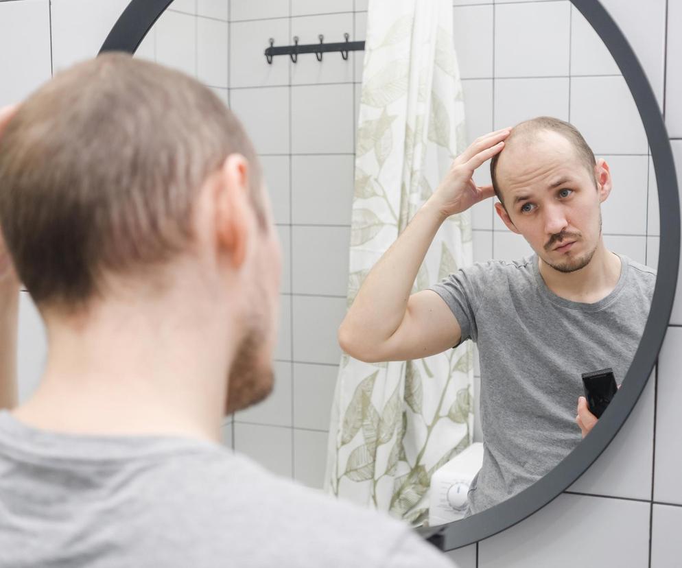 Przypadek, który może wiele zmienić. Naukowcy z nową możliwą metodą na łysienie