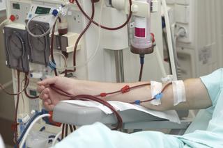 Dializa: hemodializa i dializa otrzewnowa