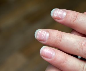 Niedobór miedzi. Objaw zauważysz na paznokciach