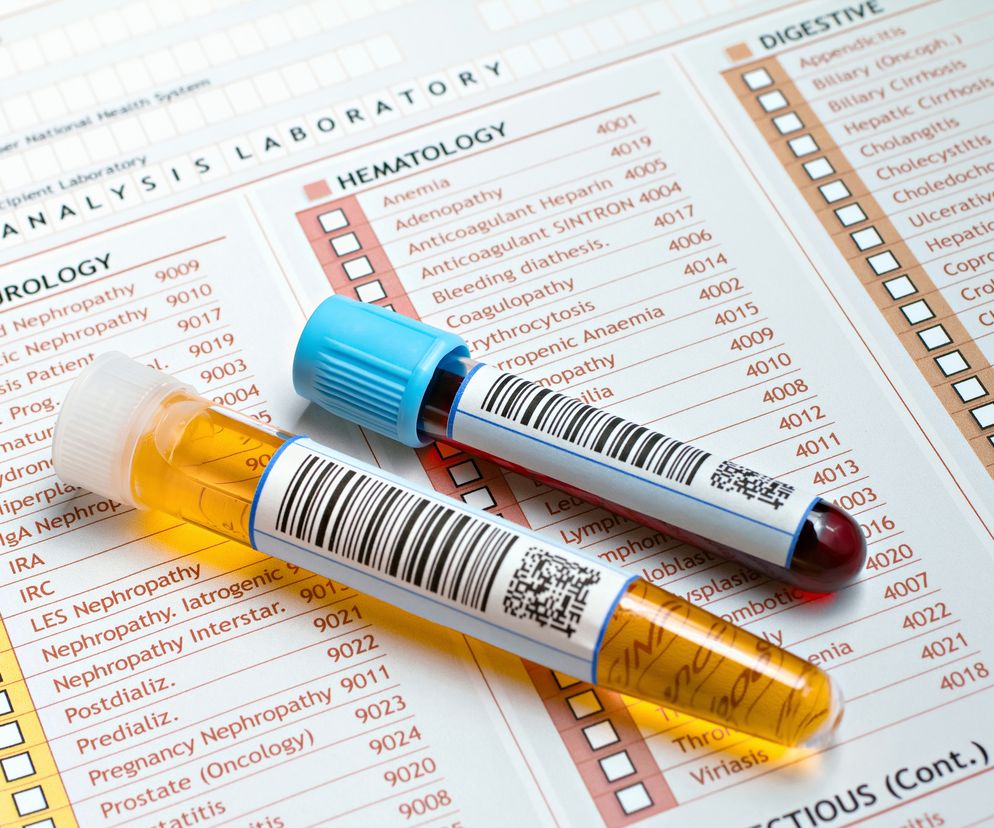 Badanie moczu daje wiele informacji na temat stanu zdrowia