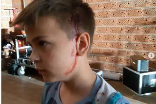 Feliks Matecki we krwi na planie serialu Dziewczyny ze Lwowa