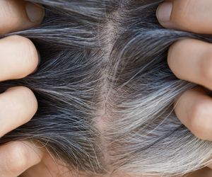 Dlaczego włosy siwieją? Winny może być niedobór tej witaminy