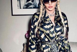 63-letnia Madonna pobita? Gwiazda opublikowała szokujące zdjęcia!