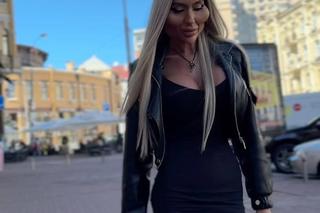 Ma największe policzki świata. Tak wyglądała 36-latka przed operacjami
