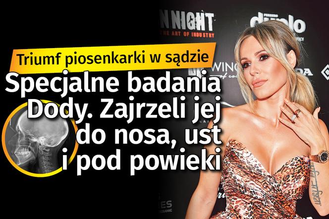 Specjalne badania Dody. Zajrzeli jej do nosa, ust i pod powieki NOWA