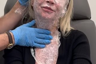 Mariola Bojarska-Ferenc kłuje się dla urody