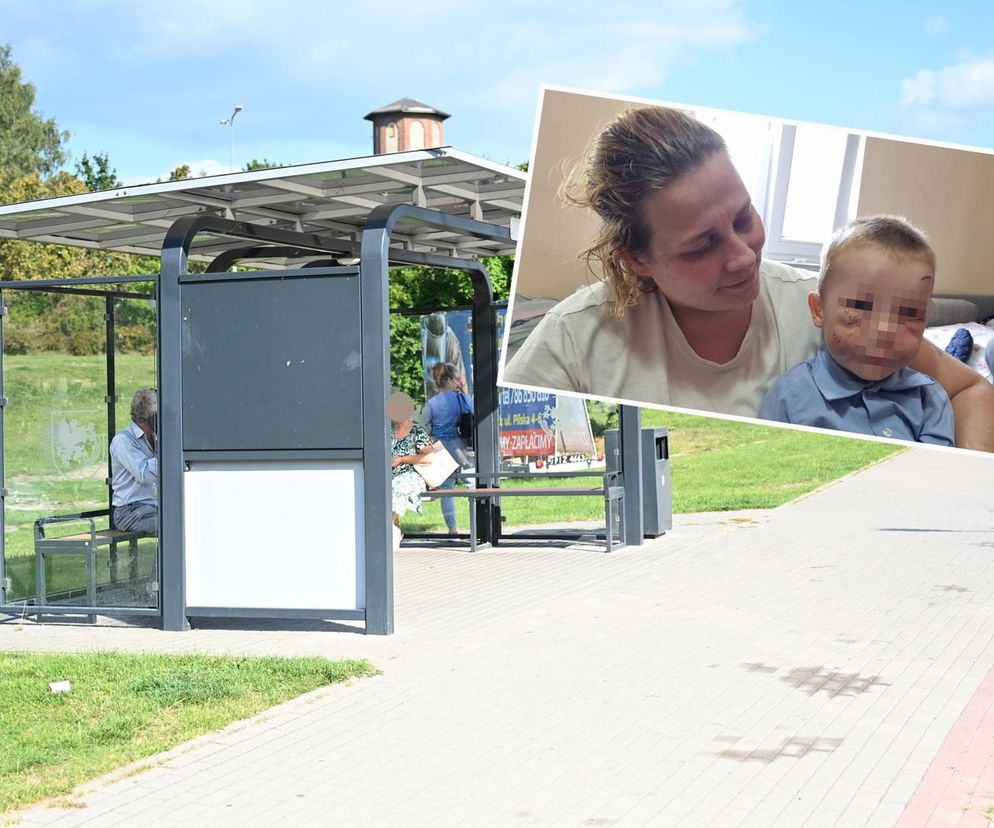 Pies pogryzł 3-latka na przystanku