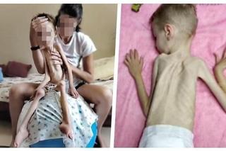  Mama przeprasza synka, że pochłonęła go choroba. 6-latek z Lublina trafił do hospicjum, ale na pomoc nie jest za późno [ZDJĘCIA]