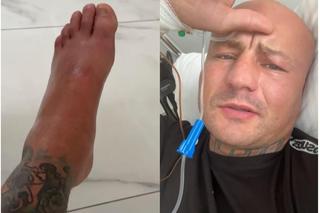 Artur Szpilka poznał diagnozę! Jego nogę zaatakowała groźna bakteria, teraz czeka go kuracja