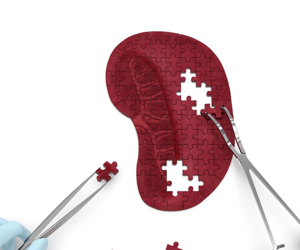 Torbiele śledziony to rzadkie zmiany, z reguły wykrywane przez przypadek.