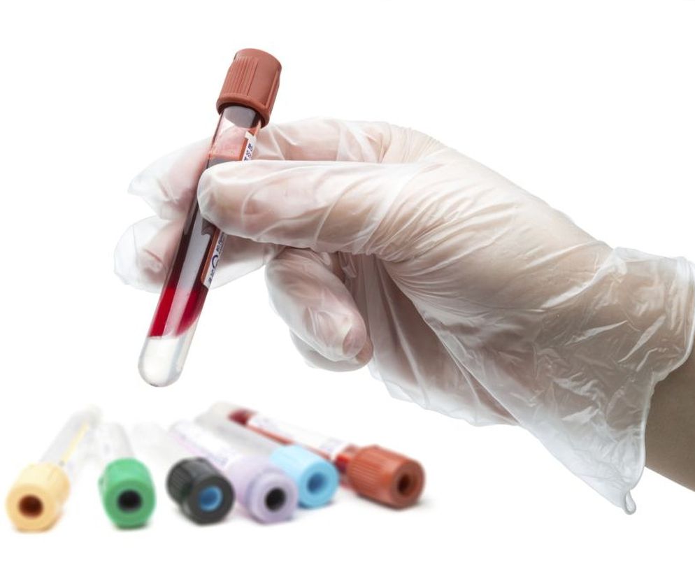 Hemoglobina glikowana  (glikohemoglobina, GHB) pozwala utrzymać cukrzycę pod kontrolą. Jakie są prawidłowe wyniki hemoglobiny glikowanej?