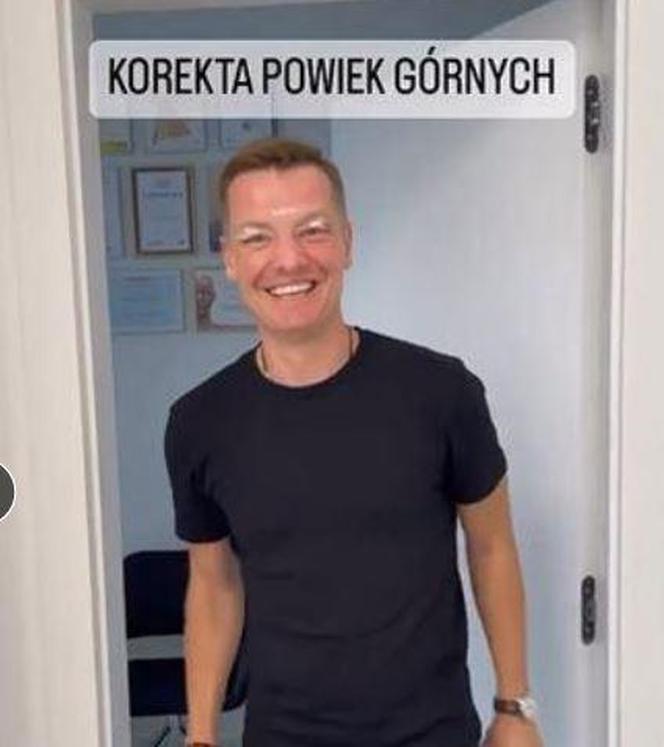 Gwiazdy wycięły sobie powieki