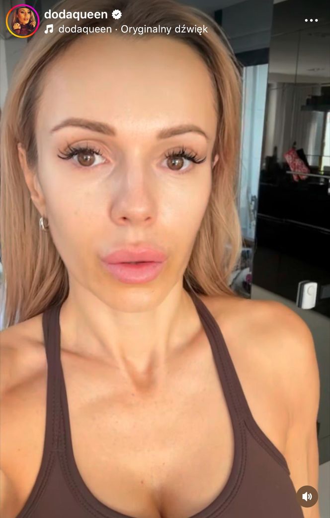 Doda pokazała bliznę po wycięciu czerniaka