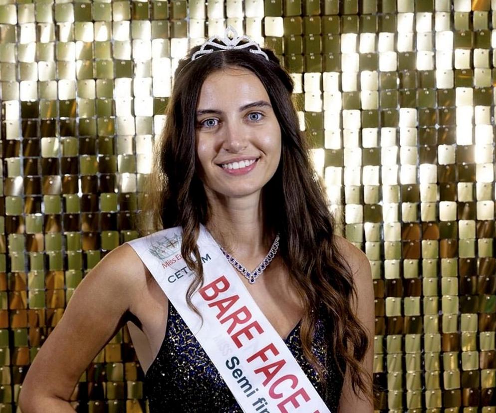 Śliczna dziewczyna bez makijażu walczy o tytuł Miss Anglii. To pierwszy taki przypadek w historii