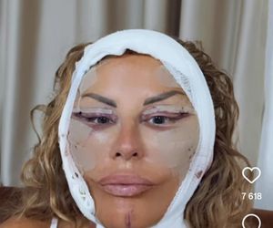 Dagmara Kaźmierska miała operację plastyczną