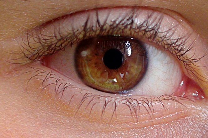 Znachor rozpoznawał choroby m.in. na podstawie wyglądu tęczówki oka