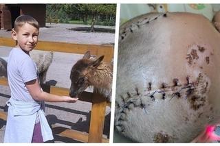 „Mamo, Ignasia uderzył samochód”. Niedziela, która zmieniła wszystko. Przywróćmy uśmiech na twarzy małego wojownika