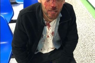 Kopali, aż ofiary straciły przytomność. Brutalny atak na Żydów w centrum Warszawy!!!