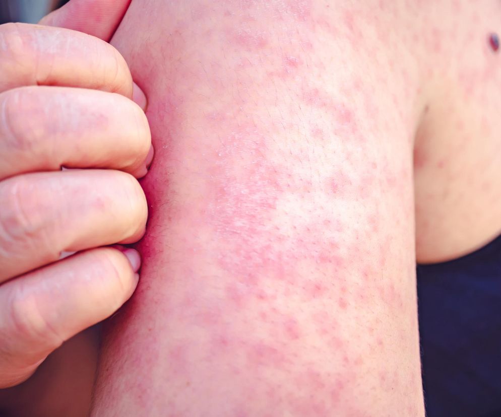 We Francji alarm przed igrzyskami. Już 8 razy więcej zachorowań, a to dopiero początek