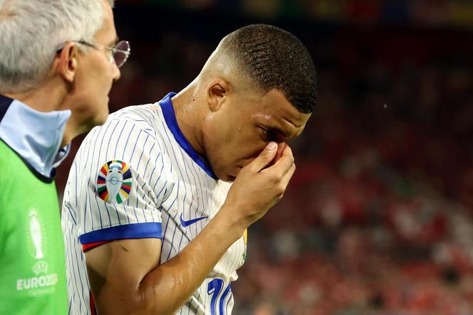 Kontuzja nosa Mbappe podczas Euro 2024