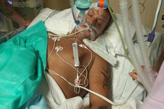 Tata czwórki dzieci uległ strasznemu wypadkowi. Andrzej potrzebuje pomocy