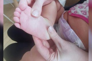 15-miesięczna Anastazja z Torunia potrzebuje pomocy