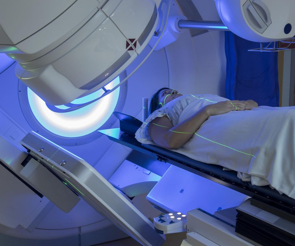 Radioterapia: jak działa? Skutki uboczne radioterapii