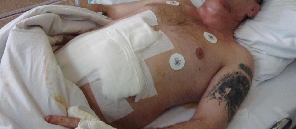 Dźgnął sąsiada bo cuchnęły mu jego ziółka