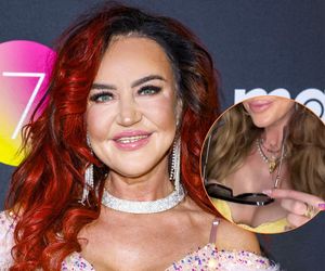 Agnieszka Kotońska pokazała posiniaczoną twarz po operacji. Szokujące wyznanie gwiazdy Gogglebox
