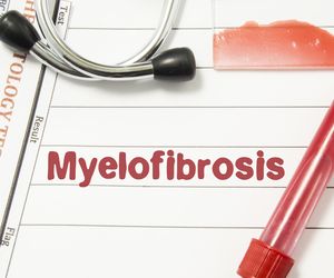 Mielofibroza czyli włóknienie szpiku kostnego: przyczyny, objawy, leczenie