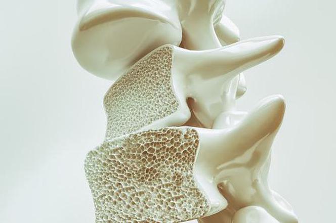 Osteoporoza to choroba nie tylko seniorów.
