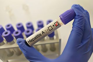 Ostrzeżenie przed podróżą do Czech! Polski MSZ mówi o wirusie