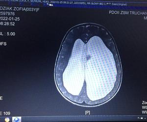 6-letnia Zosia z Tychów potrzebuje pomocy internautów, żeby stanąć na nogi 