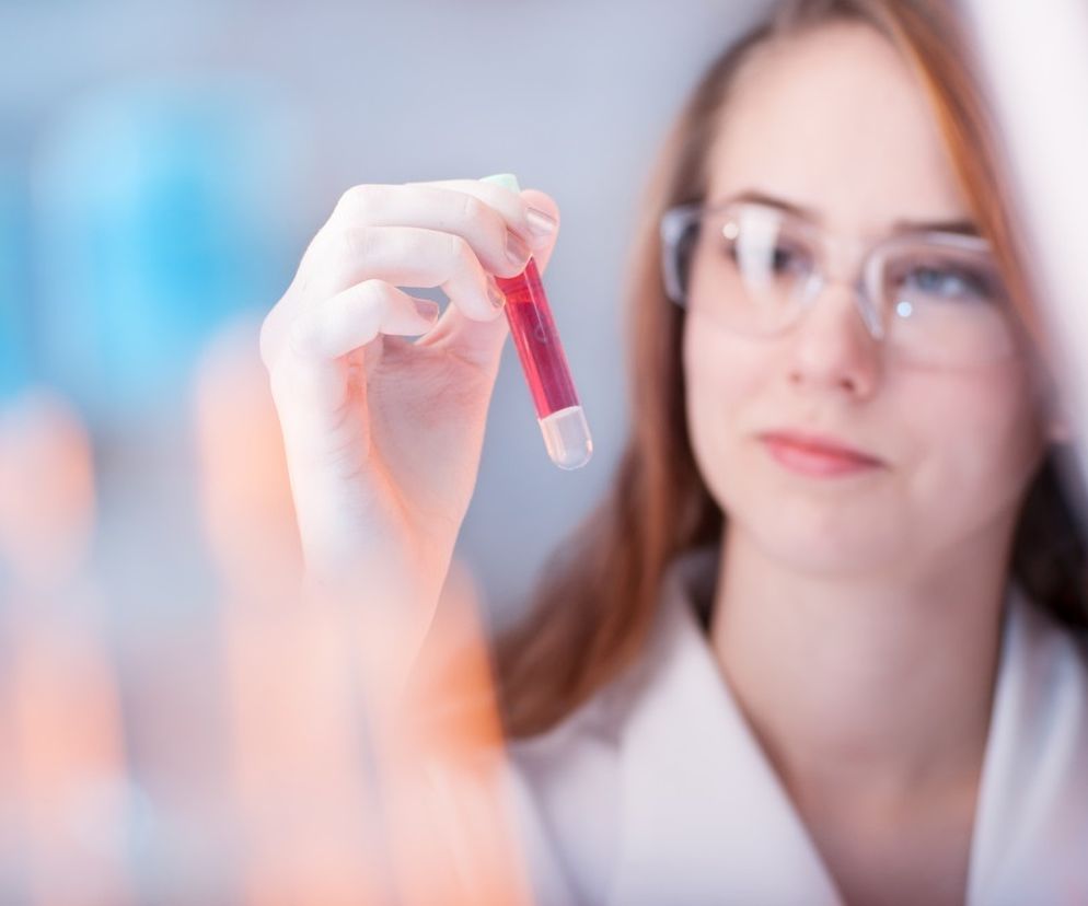 Przeciwciała anty-CCP: przebieg badania, wyniki, cena