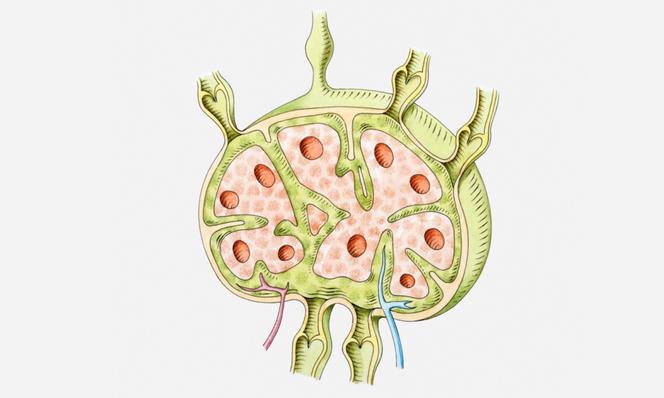 Powiekszone Wezly Chlonne Przyczyny Poradnikzdrowie Pl