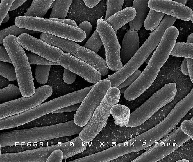 Pałeczka okrężnicy - jak wygląda bakteria E. coli