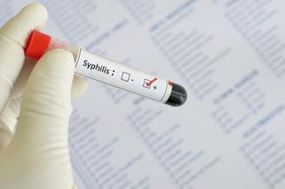Skuteczne leczenie kiły (syfilisu) penicyliną, doksycykliną, tetracykliną. Ile trwa i jak wygląda?